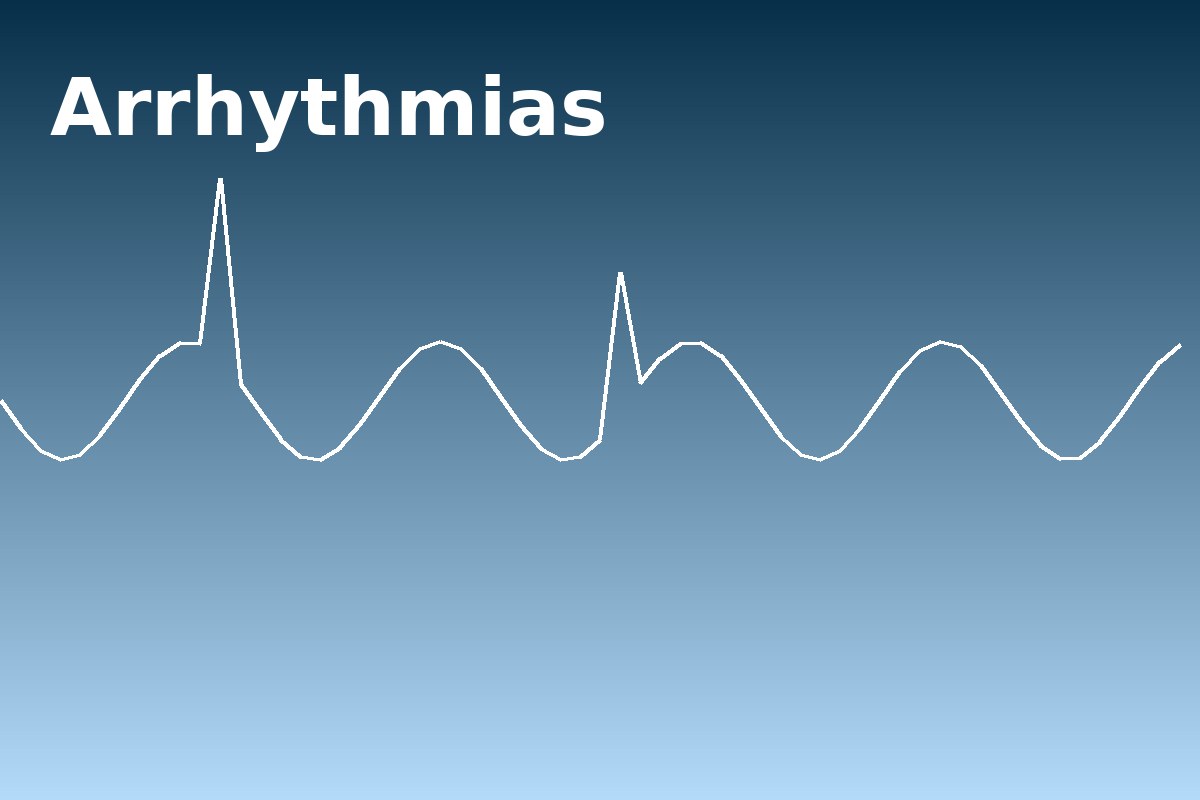 Arrhythmias